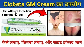 Clobeta GM l दादखाद खुजली कि दवा l Anti Fungal Anti Bacteria l लगाने से पहले वीडियो देख लें [upl. by Leidba454]