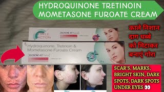 ElosoneHT cream review  Hydroquinone tretinoin Mometasone Furoate Cream  use in hindi [upl. by Zedecrem]