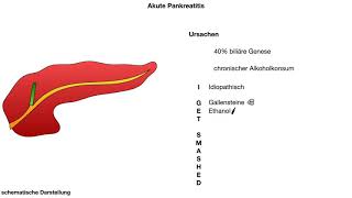 akute Pankreatitis  Ursachen wwwclipdocsde [upl. by Aramad797]
