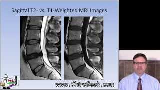 Dr Gillard lectures on How to Read Your Lumbar MRI [upl. by Yanal338]