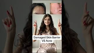 Damaged Skin Barrier VS Acne shorts [upl. by Stuart]