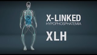 Xlinked hypophosphatemia XLH mechanism of disease [upl. by Akanke746]