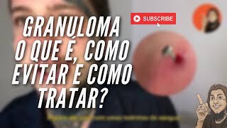 O que é o granuloma do seu piercing como ele surge e como tratar [upl. by Sualk142]