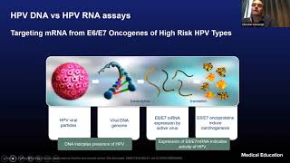 August 2021 LabCoP Extended ECHO Session HPV Testing Technologies Hologic Aptima® HPV Assay [upl. by Etakyram942]