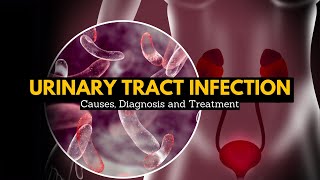 Urinary Tract Infection Causes Signs and Symptoms Diagnosis and Treatment [upl. by Yremrej]