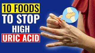 10 Incredible Foods To Stop High Uric Acid [upl. by Constanta197]