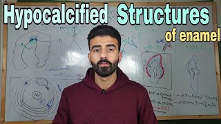 Enamel 4  hypocalcified structures of enamel  oral histology [upl. by Otreblide]