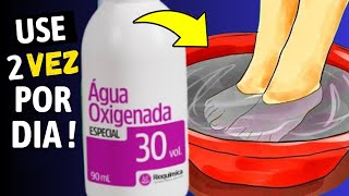 O Que Quase Ninguém Sabe Sobre a ÁGUA OXIGENADA E Que Poucos Conhecem Você Vai Se Surpreender [upl. by Trilbee]