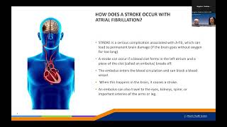 Atrial Fibrillation AFib [upl. by Elconin458]