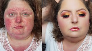 How I Cover my Rosacea with makeup Full Coverage Makeup [upl. by Haslett]