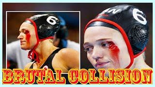 Shocking Olympic Water Polo Injury Blood Pours from Eye After Brutal Collision [upl. by Xyno]