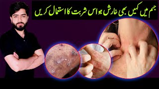 SharbateSafeen Khon Ko Saaf Krne Wala Unani Forumla  Itching Treatment At Home  Private Part [upl. by Nagiam]