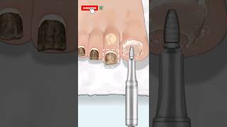 ASMR removes excess cuticlesasmrshorts animation relaxing deepcleaning cuticles [upl. by Hazem]