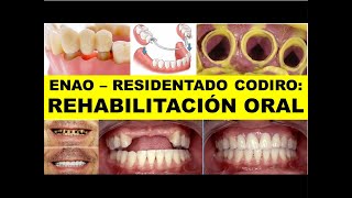 ENAO  RESIDENTADO ODONTOLÓGICO quotREHABILITACIÓN ORALquot [upl. by Naillil]