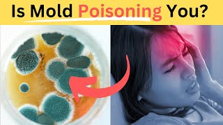 Hidden Mold Toxicity How to Recognize and Detox Safely [upl. by Anelaf]