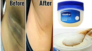 How to Get rid Of Dark Underarms in 3 Minutes  instant result  using Vaseline 100 Effective [upl. by Thomas]