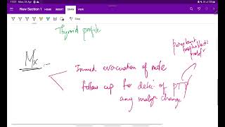 Hydatidiform mole  Molar pregnancy part 2  OG  Obstetrics  Easy notes  MeDTecH29 [upl. by Posner945]