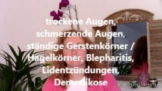 trockene Augen schmerzende Augen Hausmittel rote Augen Therapie Heilung DemodexMilbe Gerstenkörner [upl. by Dohsar]