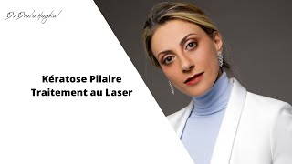 🔴Kératose pilaire Traitement au Laser [upl. by Zampino]