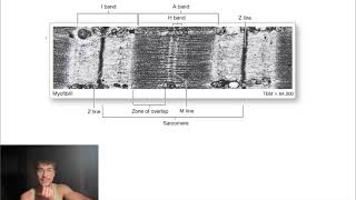 the sarcomere actin amp myosin and bands ep 2 [upl. by Doe520]