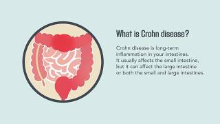 Crohn Disease Signs Symptoms Causes and Treatment  Merck Manual Consumer Version [upl. by Zoes]