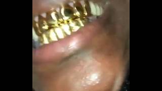 Gold Money Grillz Custom Fitted Grillz [upl. by Tarra]