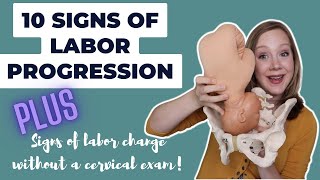 10 Signs of Labor Progression  Its WAY more than Dilation [upl. by Irahs]