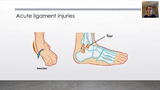 Biomechanics Tendon amp Ligament Injury [upl. by Aneej]