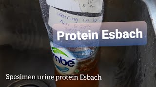 Spesimen Urine Esbach Protein 24 jam [upl. by Egroj]