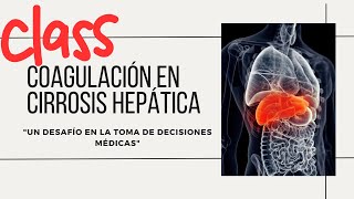 COAGULACIÓN EN CIRROSIS HEPÁTICA Un desafío en la toma de decisiones médicas [upl. by Stephani186]