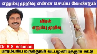 VADAPALANI PUTTUR KATTU PHALANGEAL BONE FRACTURE TREATMENT  DR RS VELUMANI [upl. by Aikat]