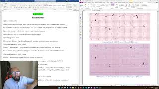 CK Cardiology  Arrhythmias  🫀 AVNRT AV Block and more [upl. by Ttirb610]