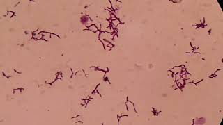 Branching Gram positive Rods Microscopy at various magnifications [upl. by Lizbeth]