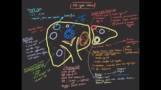 Hepatobiliary cystic lesions [upl. by Alesandrini]