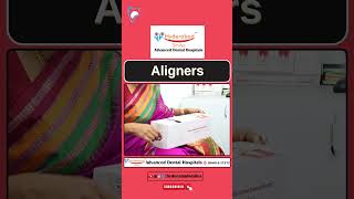 Aligners Hyderabad Smiles  Best Dental Hospital in Hyderabad [upl. by Andrel124]