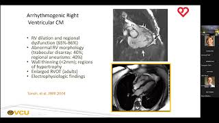 Assessment of Cardiomyopathy with Magnetic Resonance Imaging  Greg Hundley MD [upl. by Yaral]