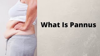 What Is Pannus [upl. by Shelli]