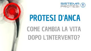 🔵 PROTESI ANCA Testimonianza di Lorenzo Lorenzi ▷▷ Come CAMBIA LA VITA dopo lintervento 🏍️ [upl. by Nithsa]