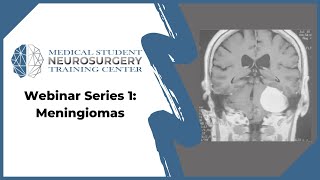 Webinar Series 1 Meningiomas [upl. by Neerual787]