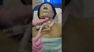 Tracheostomy Closed Suction [upl. by Emelita]