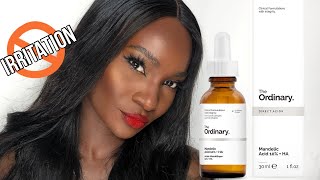 THE ORDINARY MANDELIC ACID  HA  HOW TO USE  REVIEW [upl. by Tammany]