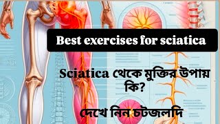 sciatica pain relief exercise  yoga and physiotherapy treatment [upl. by Goulet]