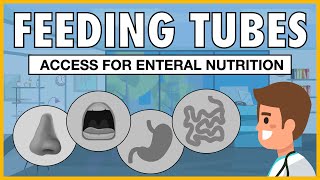 Types of Feeding Tubes EXPLAINED [upl. by Ahtar]