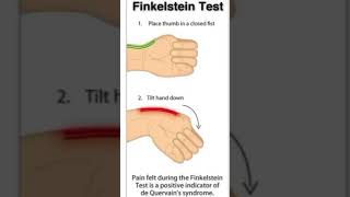 Finkelstein testthephysiodoctorsportsphysiotherapykneepainreliefhumananatomyhamstringinjury [upl. by Naujaj]