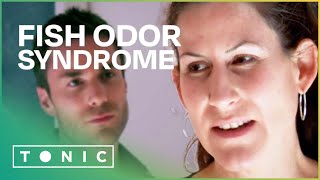 What Is It Like to Live with Fish Odor Syndrome Bad Breath Syndrome  The Food Hospital [upl. by Inahs904]