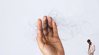 Hair Loss to Hair Regrowth A Medical Overview [upl. by Narot482]