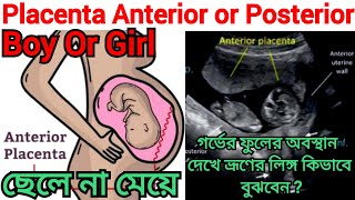 গর্ভে ছেলে না মেয়ে প্লাসেন্টার পজিসন Placenta Anterior Boy Or Girlbabybabyboyboy fhrpregnancy [upl. by Clim227]