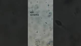 Espermatozoides al microscopio una gota shorts biologiayecologia [upl. by Giacopo]