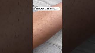 Depiladora em cristal diga adeus aos pelos depilação httpssshopeecombr1B2nZLwPU2 [upl. by Auop934]