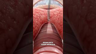 Bronchoscopy 3D Animation [upl. by Jacy255]